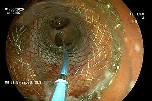 Endoskopische Aufnahme eines medizinischen Gitters mit einem eingeführten Instrument im Inneren eines Hohlorgans
